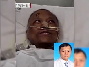 El tono de piel de dos médicos se oscureció considerablemente mientras eran tratados por el COVID-19