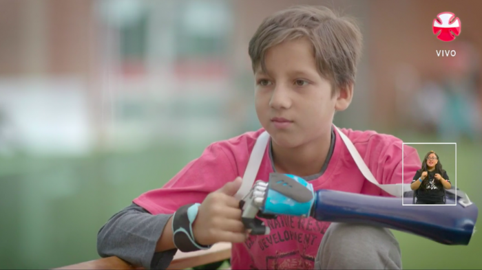 José Inostroza contó su experiencia con una prótesis electromecánica