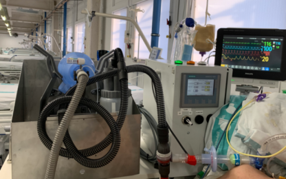 El innovador ventilador 3D que ha combatido el COVID-19 en España y podría llegar a Chile