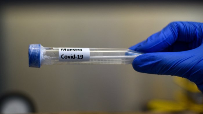 Epidemióloga aseguró que alza de casos corresponde a aglomeraciones de semana santa