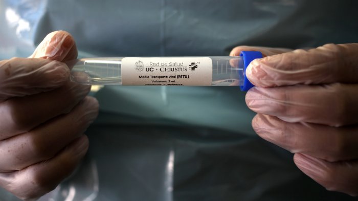 ¿Cuántos meses debería durar el confinamiento en Chile?