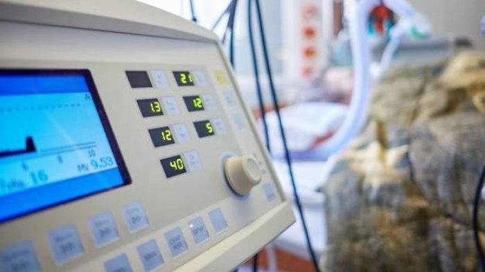 Los riesgos del Splitter: La compleja técnica que divide un ventilador entre dos pacientes