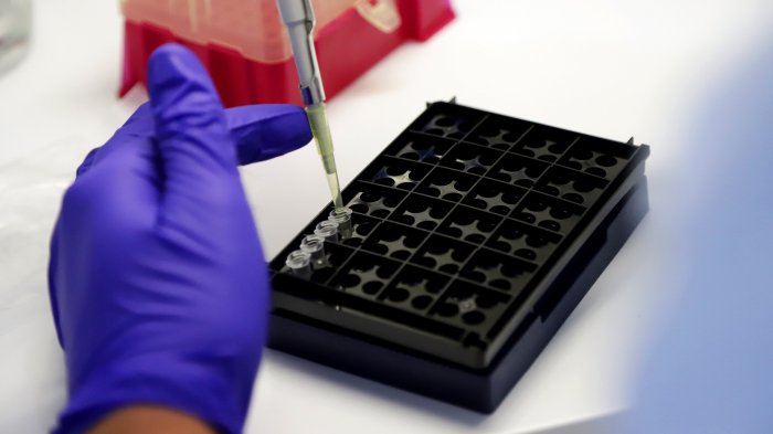 ¿Qué es el Dimero-D?: Nueva herramienta podría ayudar a doctores a identificar pacientes de alto riesgo