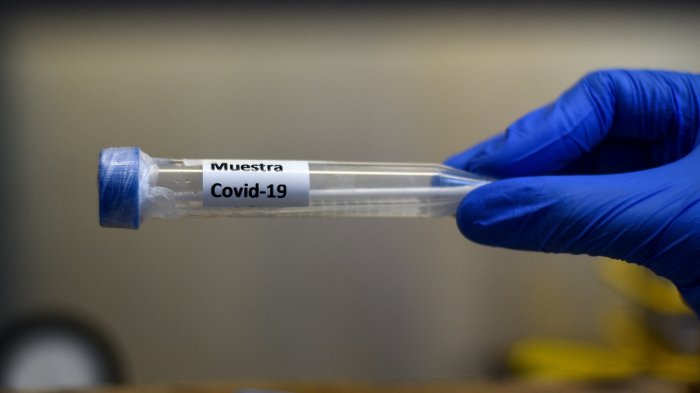 Minsal definió nuevos criterios para víctimas de coronavirus tras debate por cifras oficiales