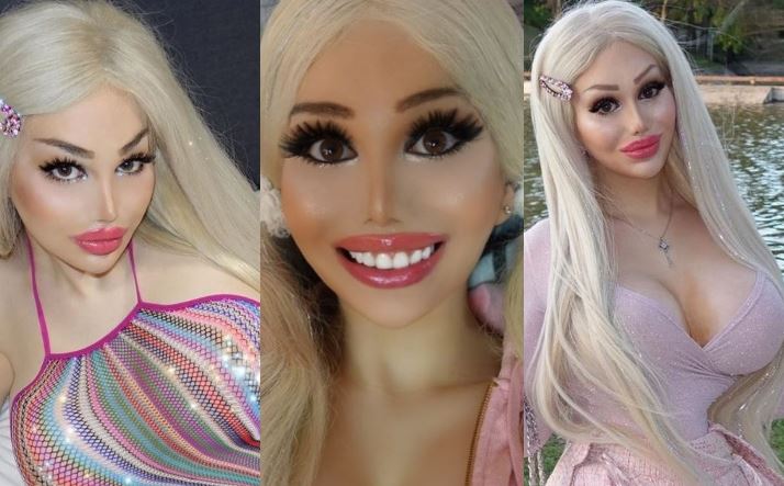 Gastó $80 millones para ser como Barbie y no podía trabajar: Dijo que la acosaban por ser “demasiado sexy”