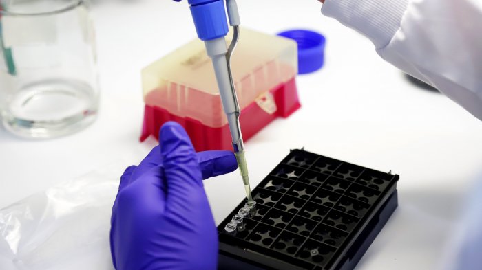 ¿Cuándo llegará la vacuna contra el COVID-19? Universidad de Oxford reveló fecha para posible cura de la pandemia