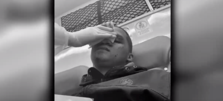 Quedó con 16 puntos y casi pierde la visión de un ojo: Motorista sufrió corte en su rostro por hilo curado