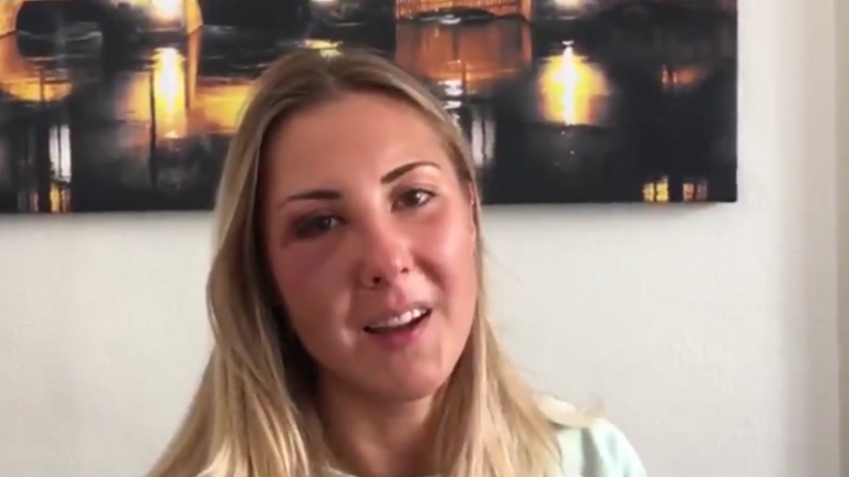 Indignación en Francia: Universitaria denunció que tres hombres la golpearon por andar con falda