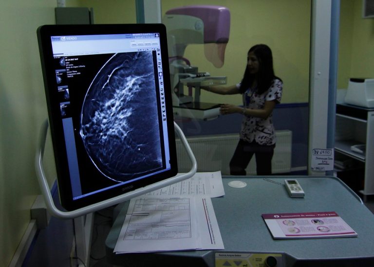 Clínicas móviles hacen mamografías: Cómo y dónde acceder al examen gratuito