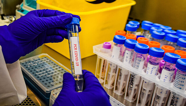 Informe ICOVID advierte leve aumento de contagios impulsados por regiones de Arica, Tarapacá, Metropolitana y O’Higgins