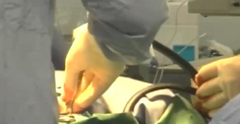 Médico tendrá que pagar $760 millones de indemnización por negligencia en cirugía bariátrica