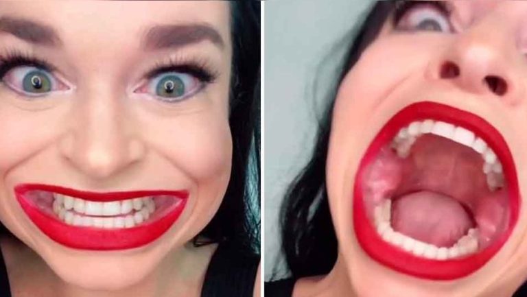 ¡Más de 10 centímetros! Mujer se hace viral por el sorprendente tamaño de su boca