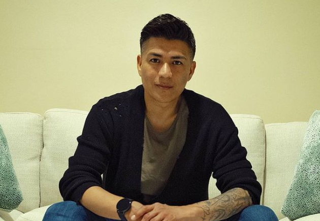 Américo sorprende con radical cambio de look: Decidió teñirse el pelo