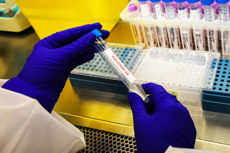 Punta Arenas vuelve a encabezar la lista: Revisa las comunas con más casos activos de COVID-19