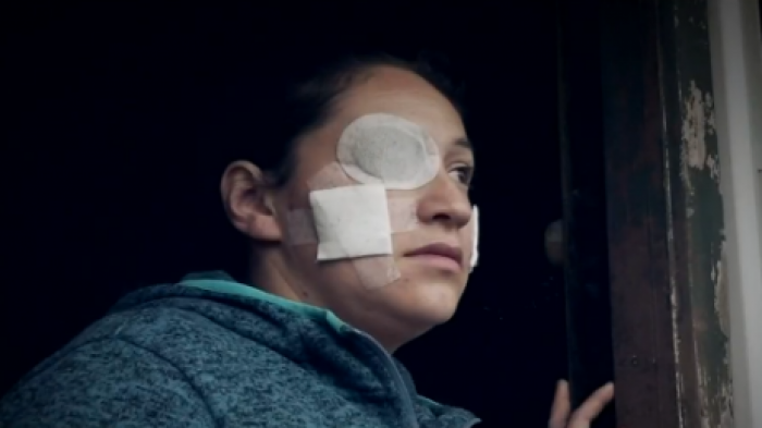 Acusa a su expareja: Dos hombres lanzaron ácido al rostro de una mujer en plena vía pública