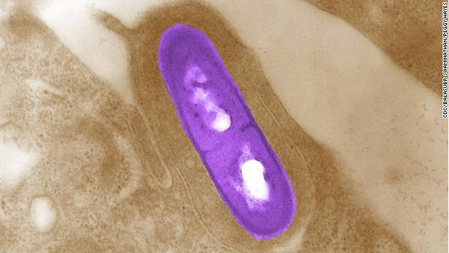 No sólo el COVID-19 preocupa a EE.UU.: CDC advierten sobre brote de listeriosis