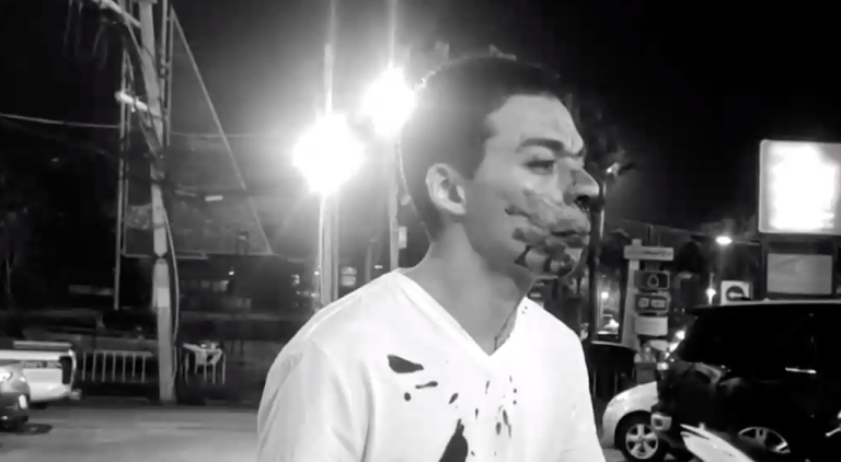 Brutal golpiza a joven chileno en Tailandia: Mototaxista lo atacó tras no entenderle en inglés