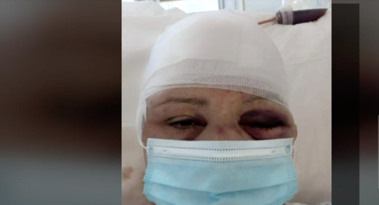 Adulta mayor sufrió grave accidente tras tropezar con scooter: Pide indemnización a empresa