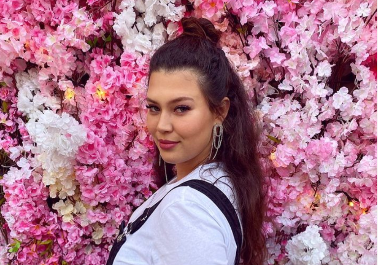 Así quedó Michelle Carvalho tras sufrir accidente automovilístico durante sus vacaciones