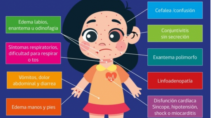 Síndrome PIMS por Covid-19: ¿Cómo detectarlo y cuáles son los síntomas?