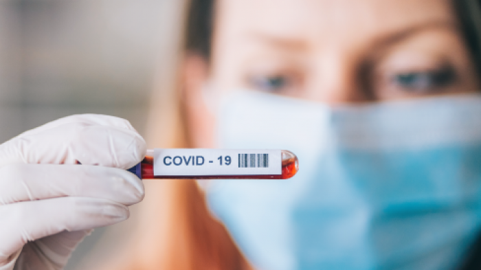 Nuevo récord de contagios de coronavirus: 7.626 casos en las últimas 24 horas