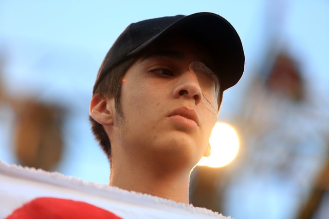 Diputados de Convergencia Social piden fiscalizar la reparación a las víctimas de trauma ocular