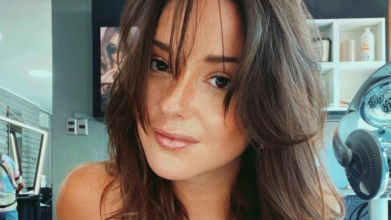 Kel Calderón contó que perdió pelo a causa del estrés: 