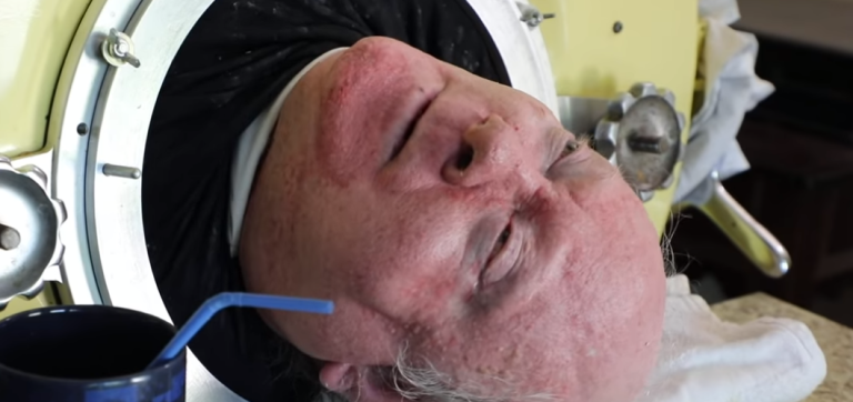 La historia del hombre que lleva 70 años sin moverse y vive gracias a un 