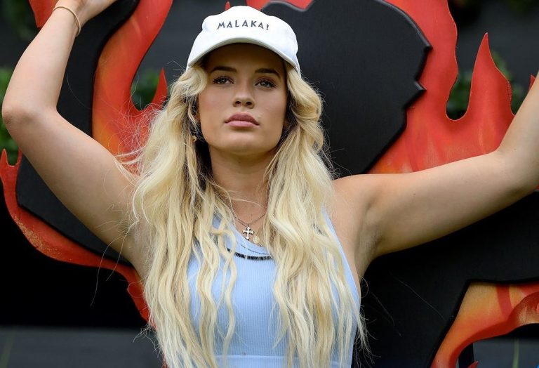 Joven australiana probó truco de TikTok para tener pecas y terminó con el rostro quemado