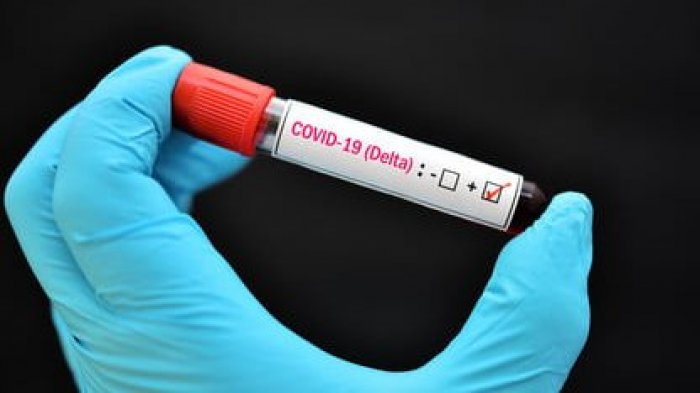 Confirman caso sospechoso de variante delta en Chile: Sería mujer que llegó desde Estados Unidos