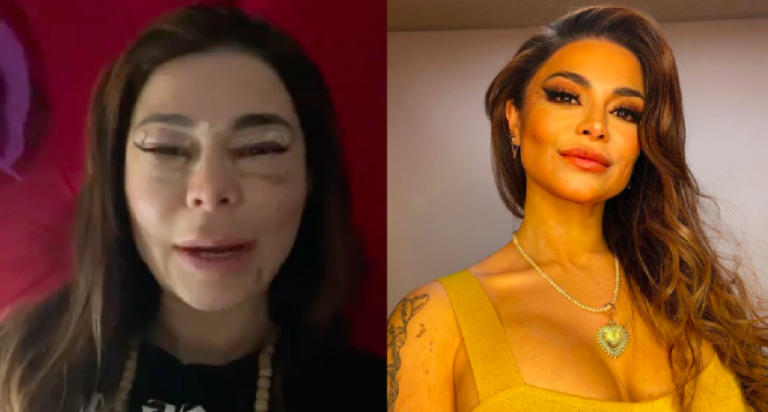 Antonella Ríos compartió video en el que muestra el proceso de su intervención en los ojos