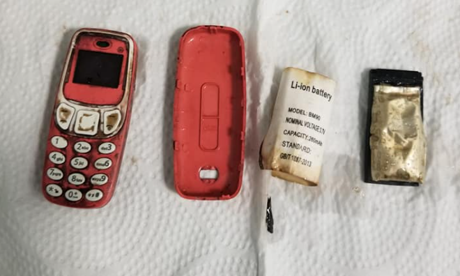 ¿Cómo llegó ahí? Hombre sintió fuertes dolores y médicos descubrieron que tenía un celular en su estómago