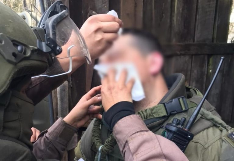 La Araucanía: Carabinero recibió impacto de perdigón en su rostro durante emboscada en Victoria