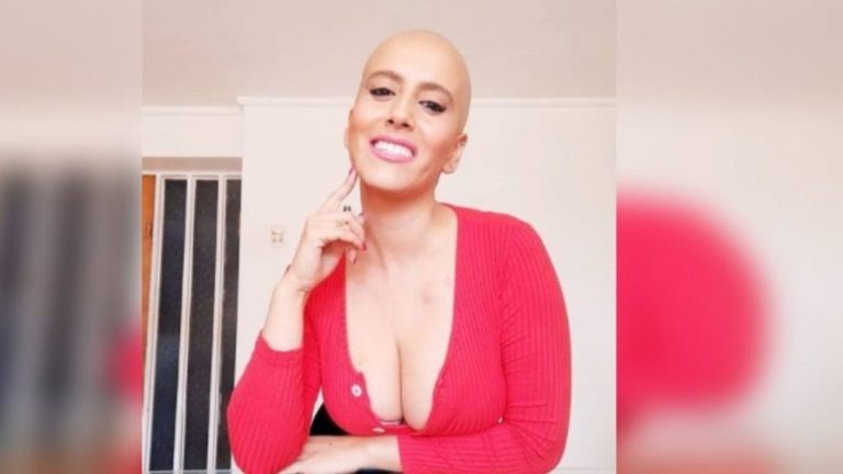 “Tengan paciencia conmigo”: Mila Correa se refirió a su cáncer