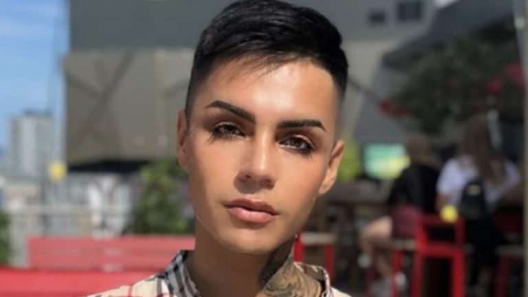 ¡Tras golpiza! Leo Méndez Jr. se sometió a operación para corregir su nariz