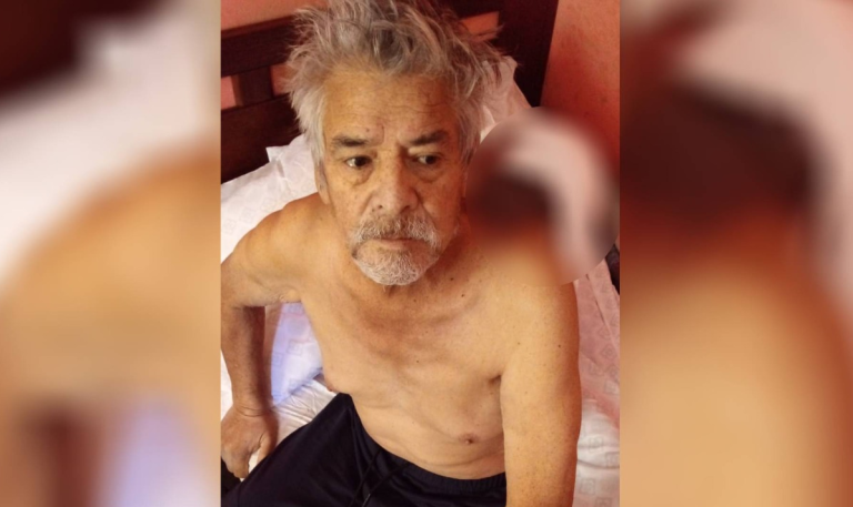 Hombre tiene tumor del tamaño de una pelota de fútbol en su espalda: 