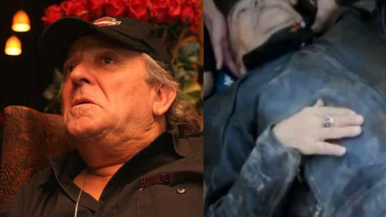 ¡Debió ser operado! Coco Legrand sufrió accidente en motocicleta