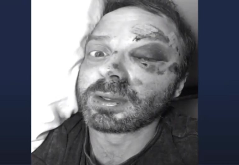 Javier Fernández sufre caída en bicicleta y asegura que venía fallada: 