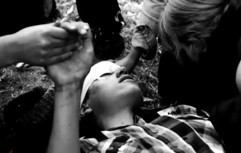 Hecho ocurrió en 2015: Víctima de trauma ocular por bomba lacrimógena pide justicia