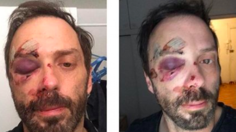 “Estoy destrozado”: Ex panelista de Maldita Moda sufrió grave accidente