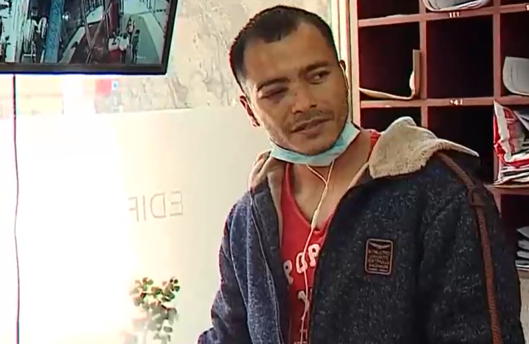 Agresor está prófugo: Conserje recibe brutal golpiza por supuesto ataque de celos