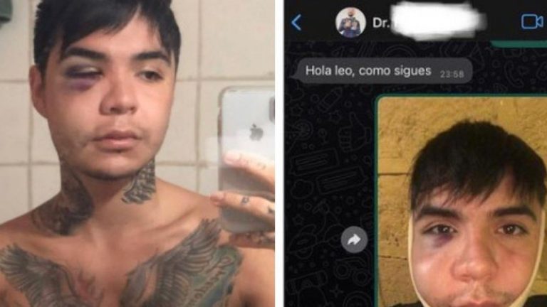 Clínica estética respondió a la funa Leo Méndez por por supuesta negligencia