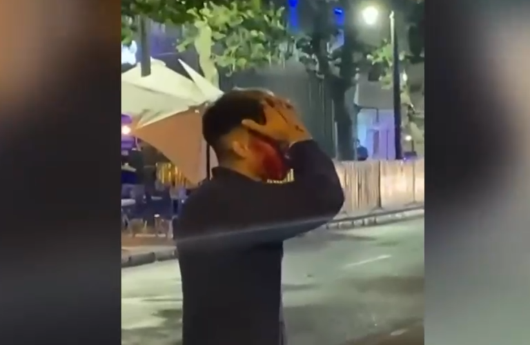 Denuncian agresión de guardias de un local en Barrio Bellavista: Más personas dicen haber vivido un caso similar