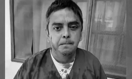 Se contagió de COVID-19 y meses después golpeó a médico tras culpar al hospital por contraer el virus