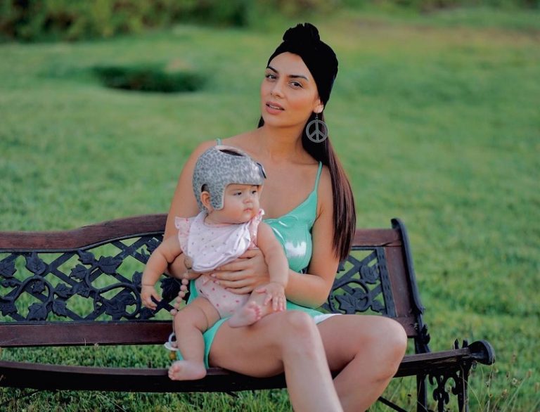 Kathy Contreras explica por qué su hija de 7 meses debe ocupar un casco ortopédico: Tiene dos patologías