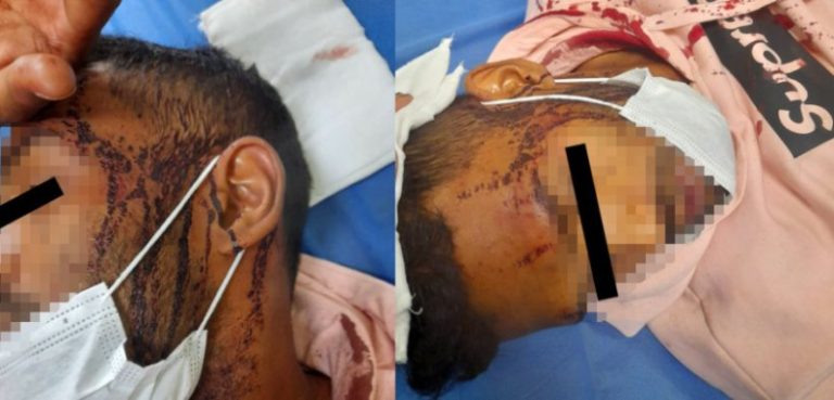 Atacan con golpes, bate y pistola a pareja gay por ir de la mano: “Asquerosos, merecen morir”