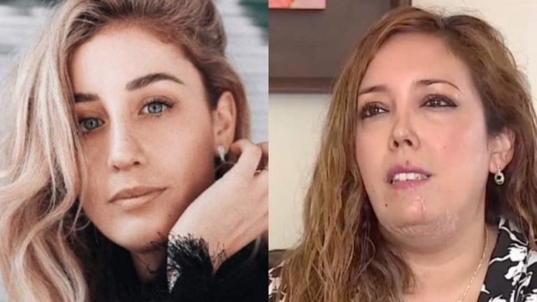 ¡Tras ataque de su perro! Este es el millonario monto de indemnización que le pedían a Daniela Castro