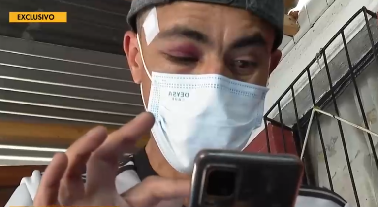 Habla hombre que asegura haber recibido un balín por parte de dueño de ex Fuente Alemana