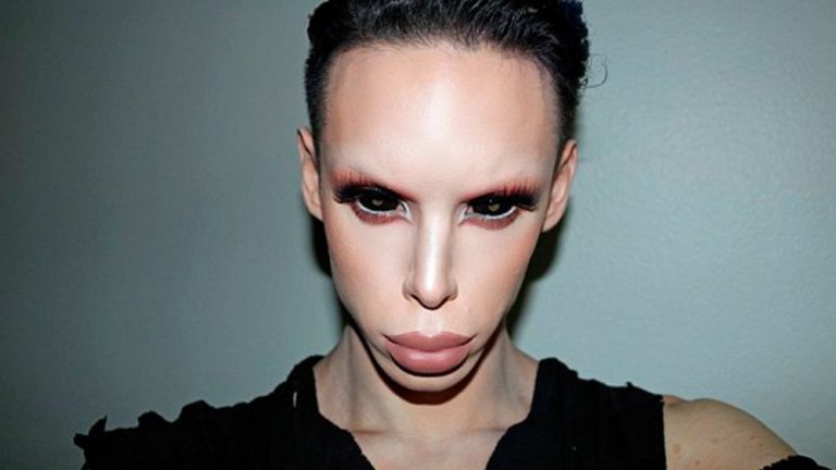 ¡Impactante historia! Joven invierte millonaria suma en 110 operaciones para parecer un 