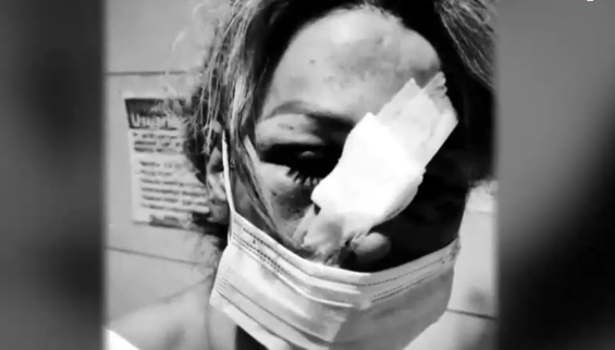 Ex integrante de Mekano fue brutalmente agredida por arrendatarios: Pidió las llaves tras meses de deudas